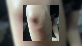 Dianiaya Mantan Kekasih di Cikembar Sukabumi, Perempuan ini Melapor ke Polisi