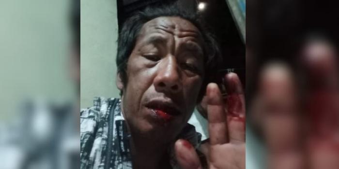 Teraniaya 24 November 2023, Nelayan di Kupang Kini Jadi Tersangka Penganiayaan